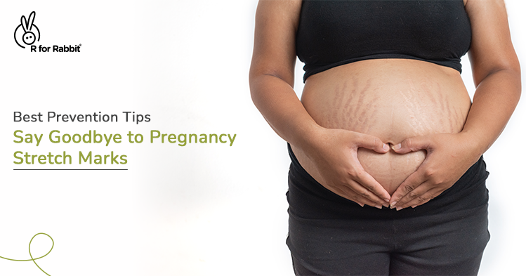 Effective Tips to Avoid Pregnancy Stretch Marks
