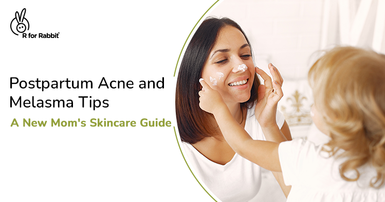 A New Mom's Guide to Treating their Postpartum Acne and Melasma